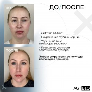 558462d1-4873-4432-9873-9b40db4acc47