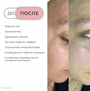 RICH-контент-фьюжн_fusion-4