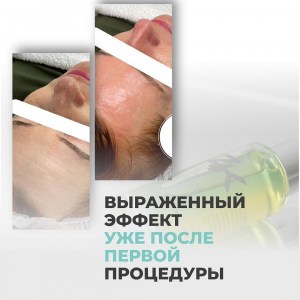 de51ee50-866b-456b-961d-b1a6de21c69f_8_11zon