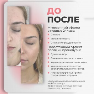 rich-контент-agt-bio-v-2_vit-amino-3-scaled
