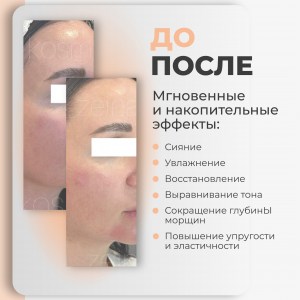 rich-контент-agt-bio_cologenum-3-2-scaled
