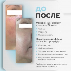 rich-контент-agt-bio_nano-3-копия-scaled
