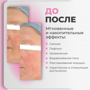 rich-контент-agt-bio_young-shine-3-2-scaled