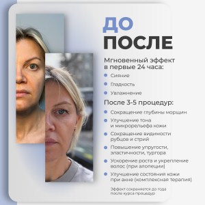 рич-контент-2025-_nucleo-3