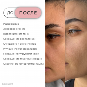 рич-контент-радиант_radiant-4